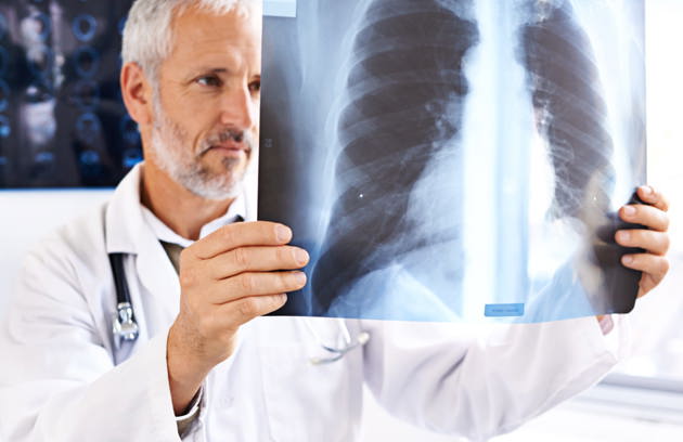 Senior Doctor Research Xray Thinking Health Service Orthopedic Man With Ideas Lung Surgery Medicine Radiology Study Bronchitis Problem Solving With Surgeon Clinic