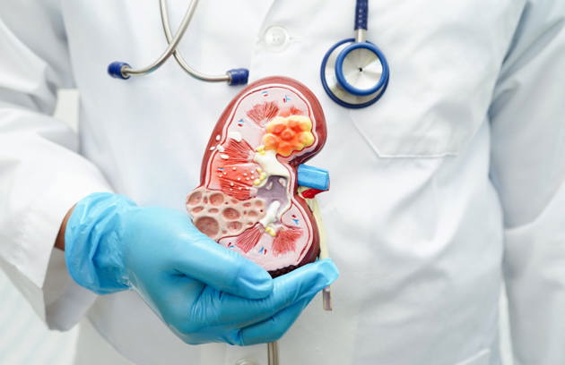A doctor holding a kidney anatomy model during a consultation at a Nephrology Hospital in Sharjah.
