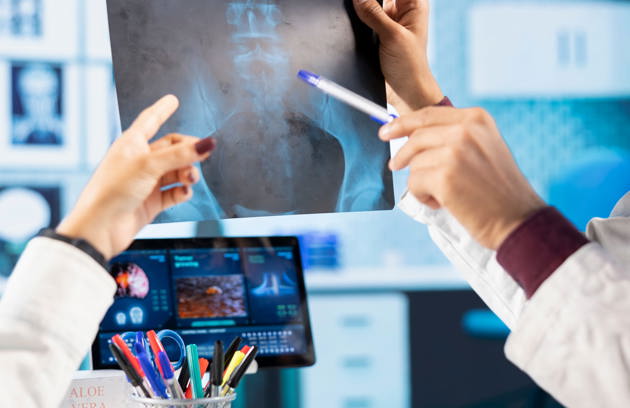 General Practitioner Consulting Patient Reviewing X Ray Test Results